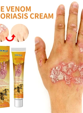 Skin Repair Balm Relieve Itchy Skin Repair Hand Foot Moss Mo