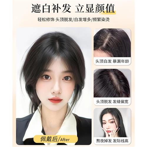假发女片头顶真发全真人发蓬松高颅顶遮白发盖头发稀少无痕补发片