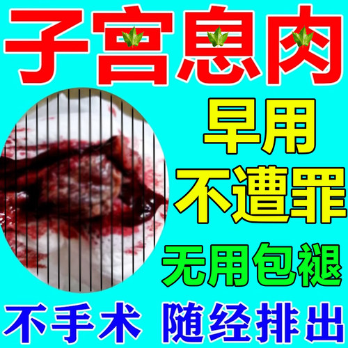 子宫i内膜i息肉i药治疗i腺i肌i症子宫内膜调理增厚异位专用中药贴