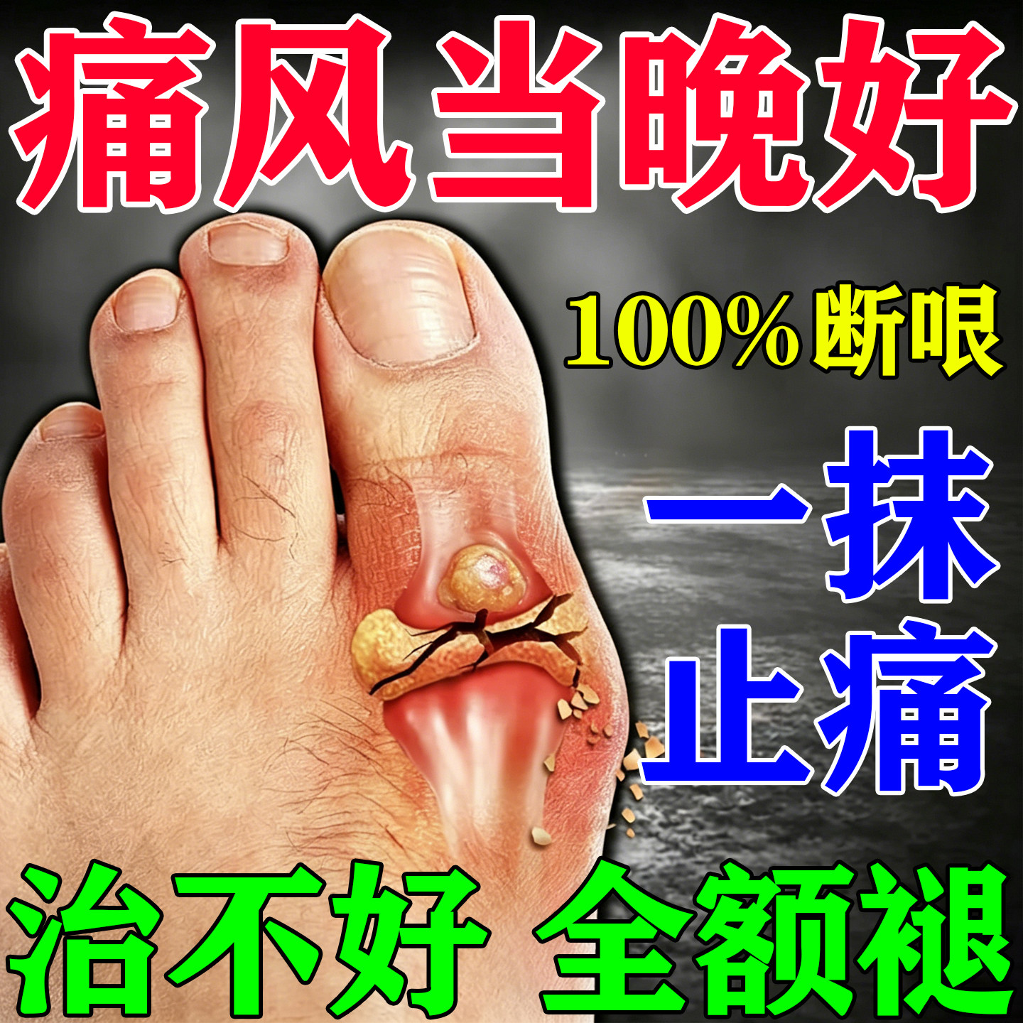 痛风降i尿酸溶石去结晶专用贴断i根手脚肿胀痛风消肿止痛膏药特效