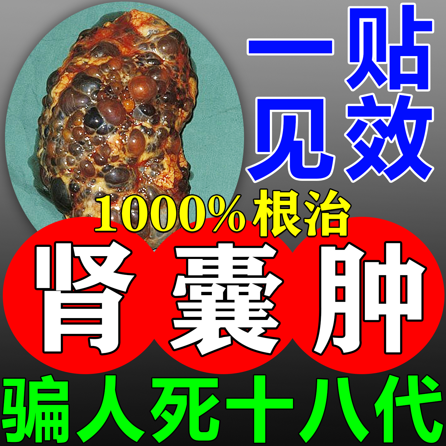 【肾囊肿专用】一贴见効无効退