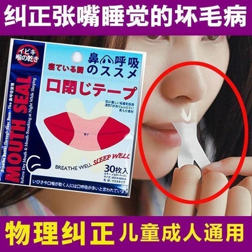 防止嘴巴闭口呼吸矫正器