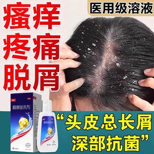 康王去屑止痒洗发水露正品官方旗舰店溢脂性皮炎皮屑痒酮康唑洗剂