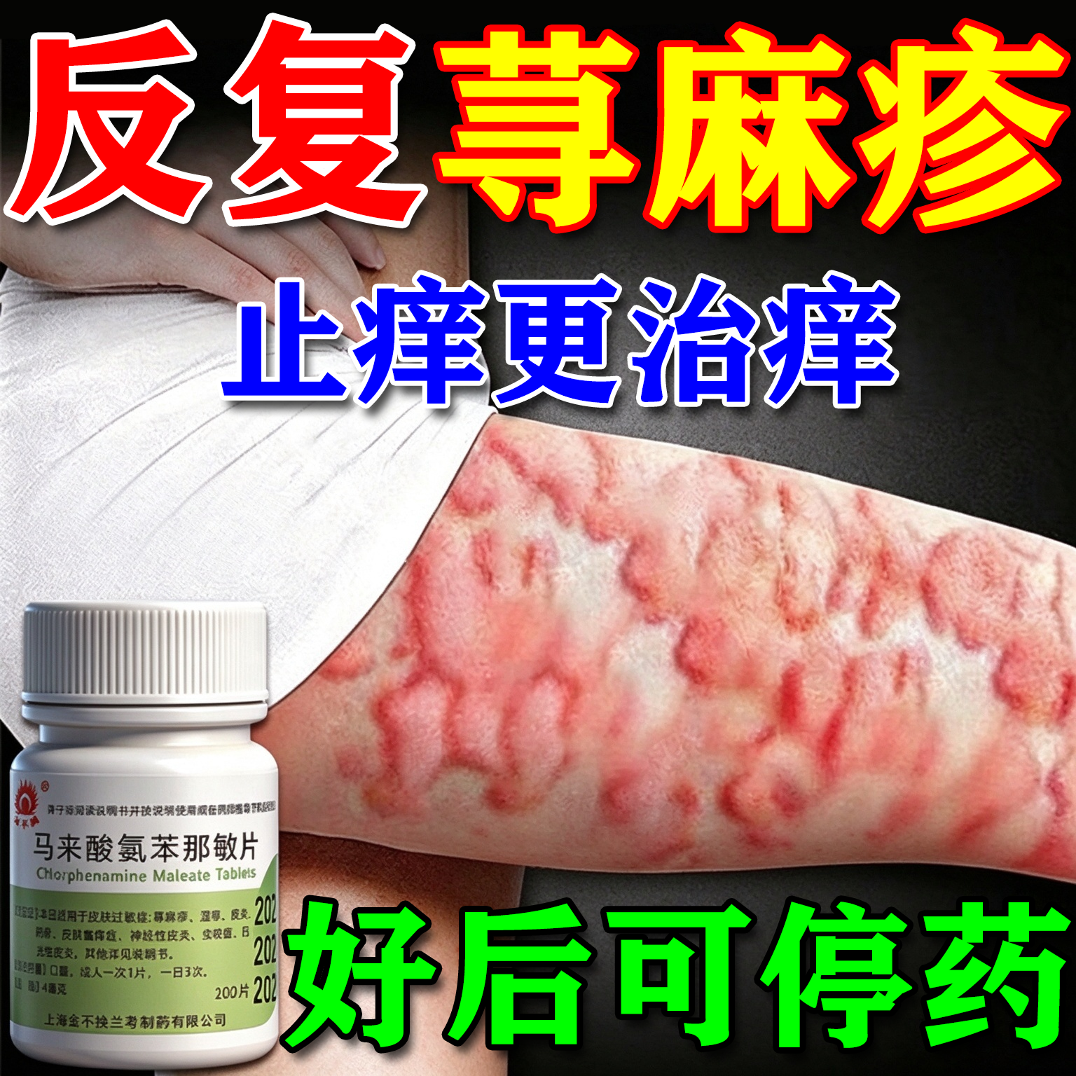 马来酸氯苯那敏片治疗荨麻疹的药红肿疙瘩鼻炎湿疹皮炎皮肤瘙痒症