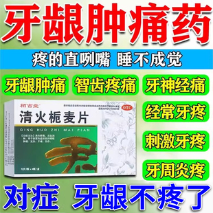 清火消炎牙龈肿痛药牙根炎中药牙周炎牙神经疼牙龈脓包清火栀麦片