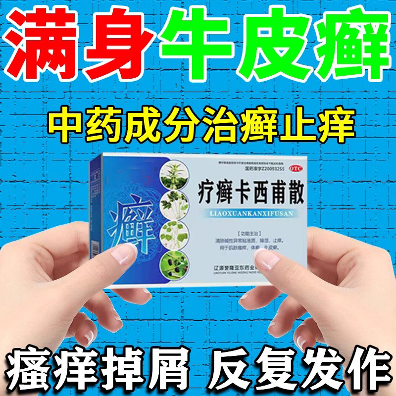 疗癣卡西甫散主治牛皮癣口服药皮肤瘙痒红肿脱屑反复治癣止痒中药