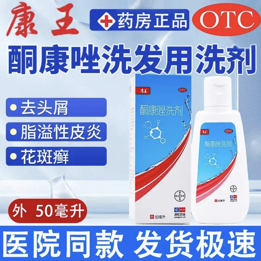 酮康唑洗剂去头屑正品OTC专用药严重头屑脂溢性皮炎头痒专用洗剂
