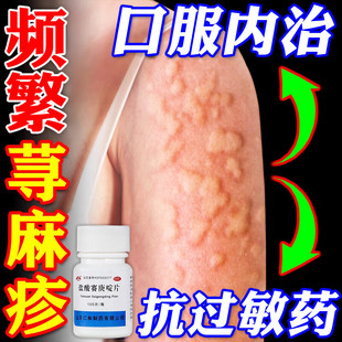 盐酸赛庚啶片治疗寻荨麻疹皮炎过敏药引起浑身皮肤特痒止痒的效药