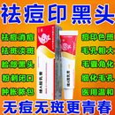 a维生素a酸乳胶膏医用官方旗舰店祛痘痘药膏皮脂汗腺痤疮去老年斑