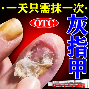 重度灰指甲专用药指甲真菌感染脱甲坏甲药灰指甲特新效期的正品药