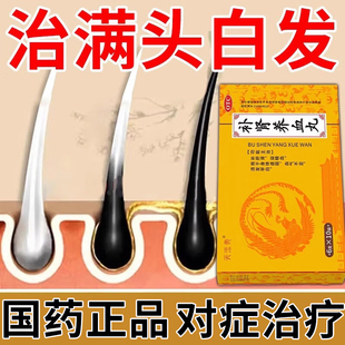 补肾养血丸 治白头补肝肾补气血的药补肾阴阳两虚固精强肾