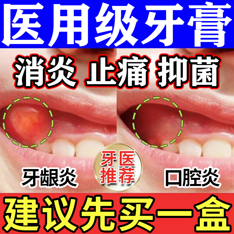 丁硼牙膏乳膏牙周炎专用牙痛红肿速效消炎止痛牙龈出血官方旗舰店