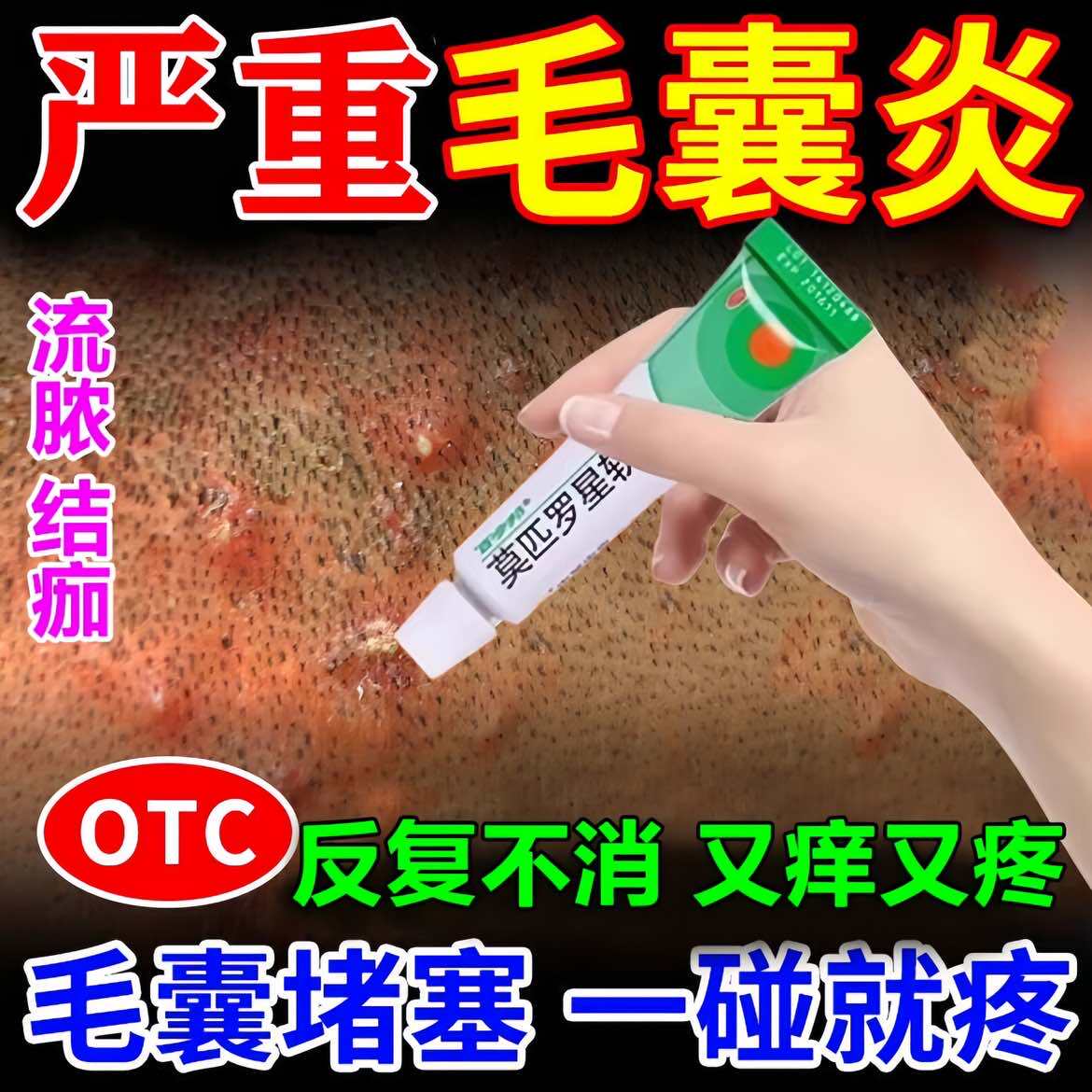 【百多邦】莫匹罗星软膏2%*10g*1支/盒