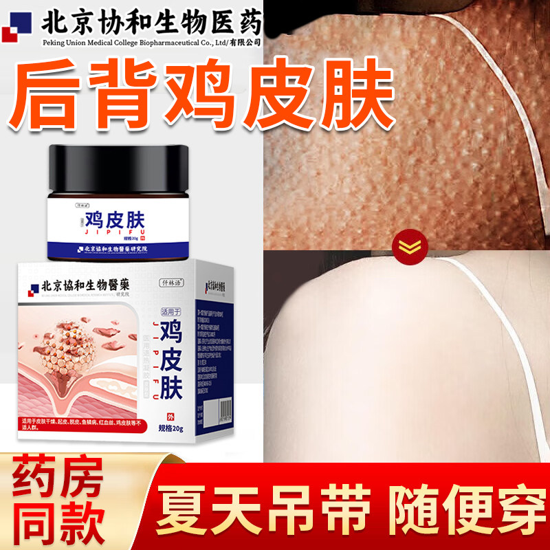 后背鸡皮肤疙瘩毛囊角化质鱼鳞背部皮肤粗糙干燥发黄痒全身可用kj