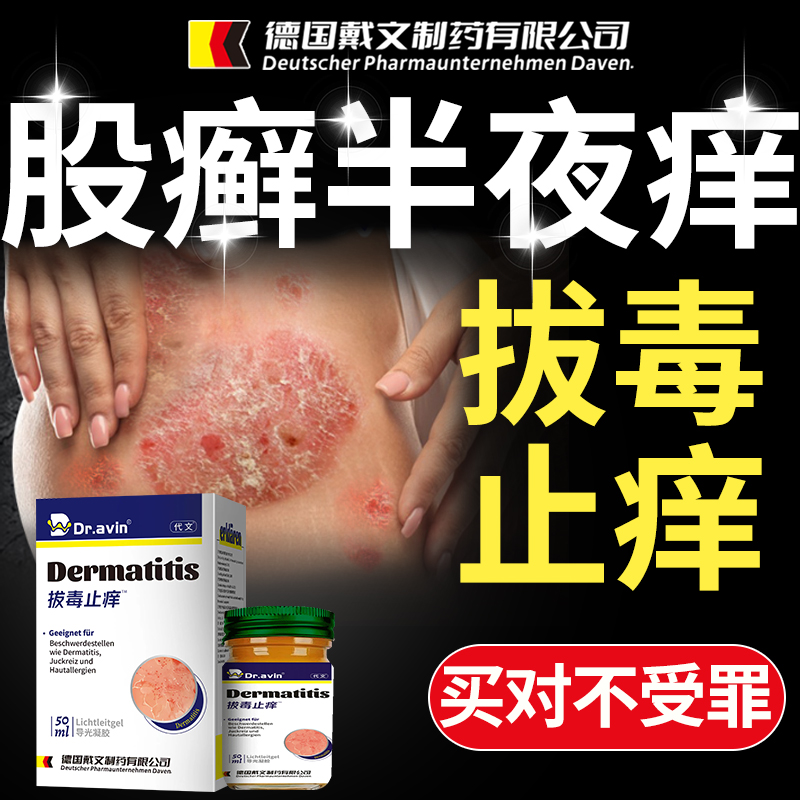 大腿内侧皮肤瘙痒股癣止痒去真菌感染...