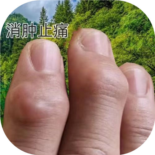 手指骨节粗大变形手指关节疙瘩鼓包手指肿大消肿止痛手指关节变形