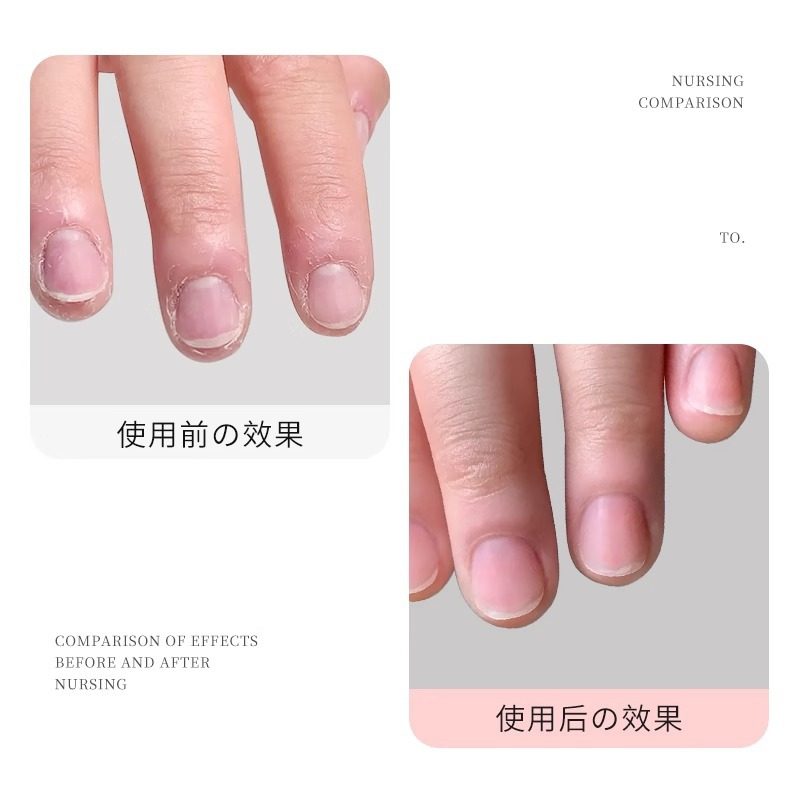 指甲营养油笔护甲油滋养防倒刺去死皮角质指皮软化剂美甲护理,彩妆/香水/美妆工具,指甲油,淘宝优惠券,粉丝福利购,淘宝优惠卷