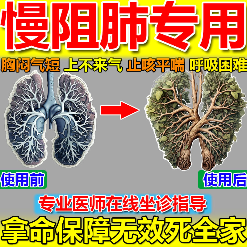 慢阻肺特效药治疗呼吸困难老慢支止咳化痰胸闷气短清肺止咳平喘贴