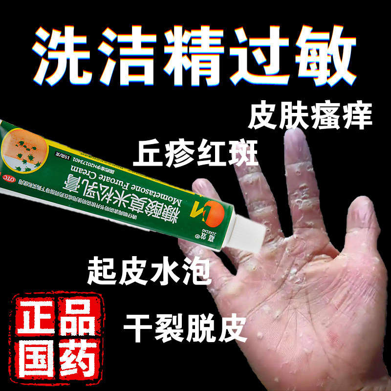 洗洁精过敏药膏糠酸莫米松乳膏国药正品手指上起水泡湿疹烂手丫药