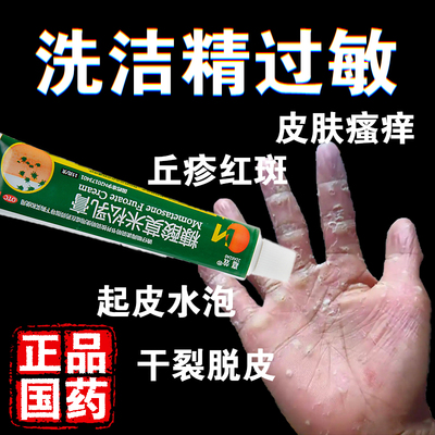 洗洁精过敏药膏糠酸莫米松乳膏国药正品手指上起水泡湿疹烂手丫药
