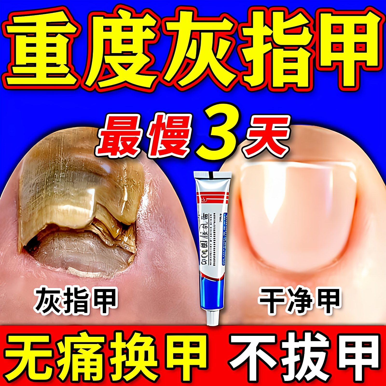 【金归】环吡酮胺乳膏1%*20g*1支/盒