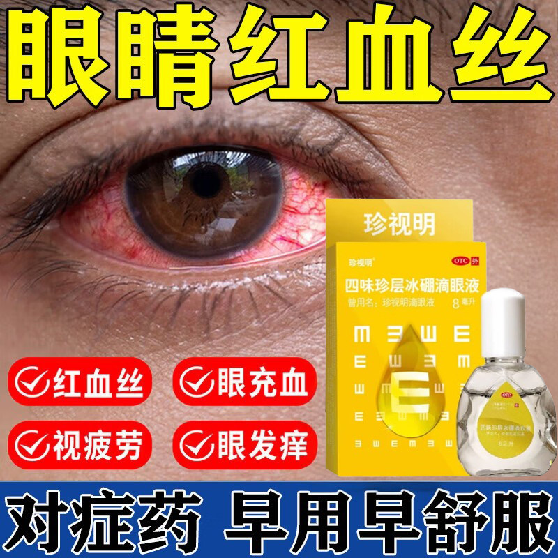 珍视明滴眼液官方旗舰店眼干眼涩缓解眼疲劳熬夜玩手机用眼过度药,OTC药品/国际医药,眼,淘宝优惠券,粉丝福利购,淘宝优惠卷