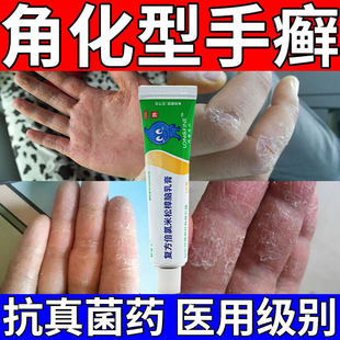 复方倍氯米松樟脑乳膏手癣脱皮干裂真菌感染鹅掌风外用皮肤抗菌药