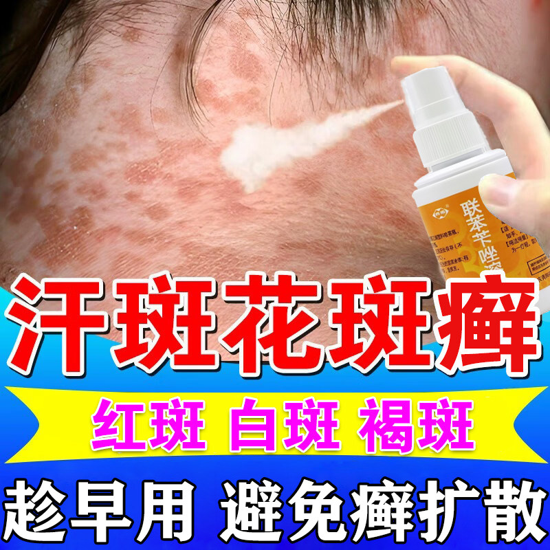 汗斑花斑癣专用特药膏效白斑褐斑花斑皮肤真菌感染用联苯苄唑喷液