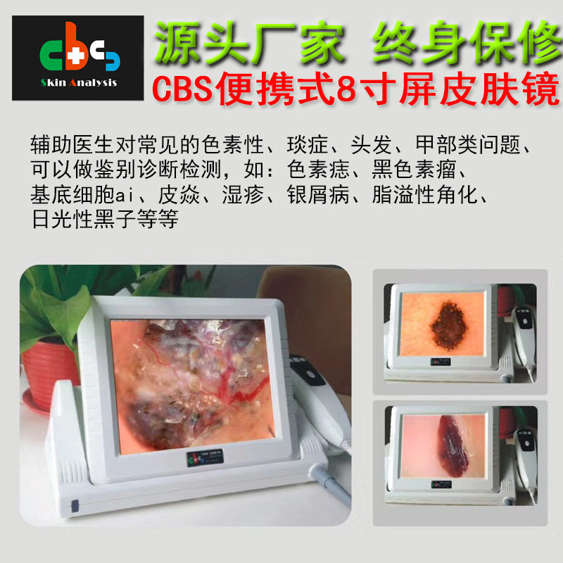 【终身保修】8寸液晶屏高清 皮肤检测一体机皮肤镜 肤测 分析测试