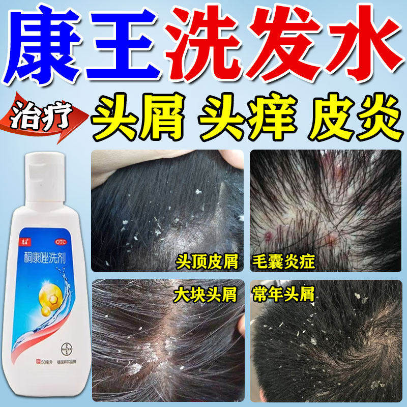 【康王】酮康唑洗剂2%*50ml*1瓶/盒