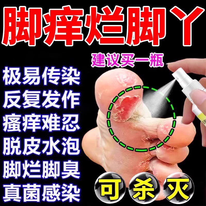 治脚气专用药水泡脱皮止痒真菌烂脚丫痒脚趾缝糜烂型治疗真菌感染