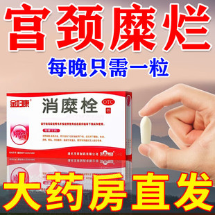 消糜栓治疗宫颈糜烂的药宫颈糜烂重度用中药白带异常房事出血
