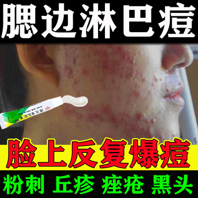 【顺峰】维生素B6软膏1.2%*10g*1支/盒