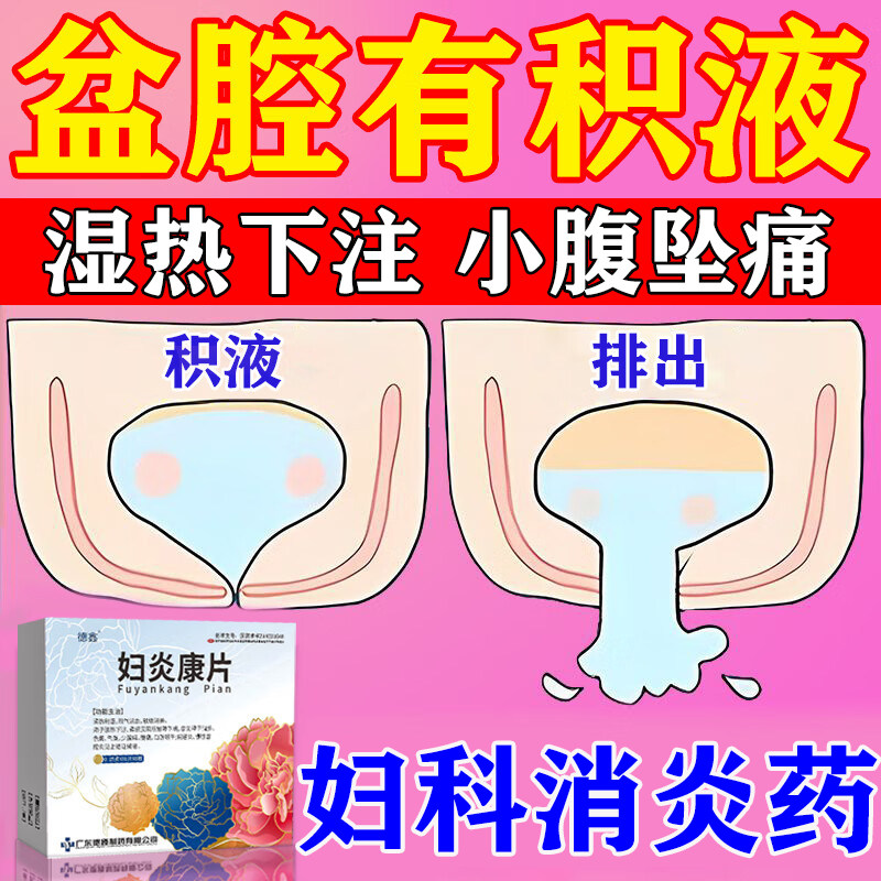 妇炎康片官方旗舰店治疗盆腔积液专用药妇科炎症专用口服消炎药