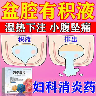 妇炎康片官方旗舰店治疗盆腔积液专用药妇科炎症专用口服消炎药