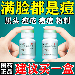 祛痘清热解毒片抗炎祛痘内服治暗疮去玫瑰痤疮痘痘祛痘印中成药