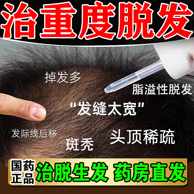 【斯必申】米诺地尔搽剂2%*30ml*1瓶/盒