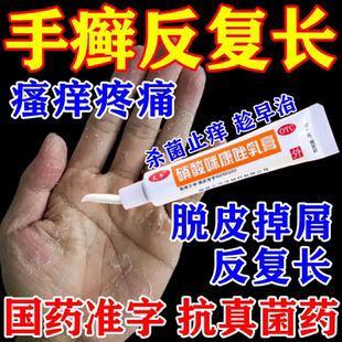 治疗手部角化型手癣脱皮干痒干裂真菌感染止痒专用硝酸咪康唑乳膏