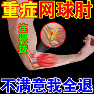 【不打封闭】重症胳膊肘外侧关节疼痛压痛肌腱损伤无力XA