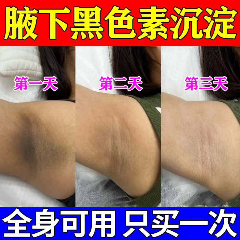 【全身可用】去黑去死皮美白药膏