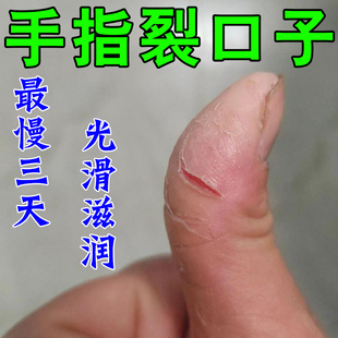 手裂口干裂修复霜秋冬季指甲缝干裂手指脱皮开裂手脚干裂防开裂膏