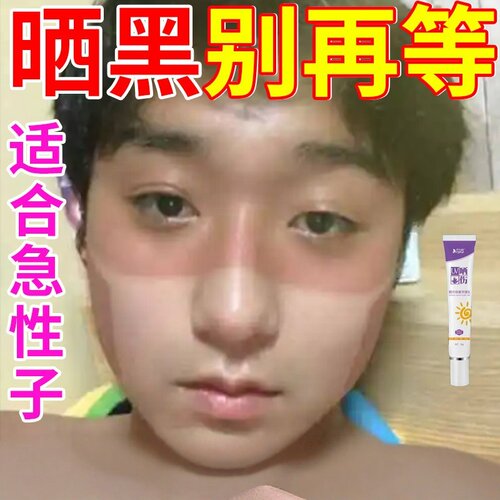 晒黑了修复男女士防脖子手臂军训皮肤晒伤修复乳