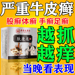 牛皮藓银屑病专用皂顽固性皮肤癣痒股藓体癣脚癣真菌感染杀菌止痒