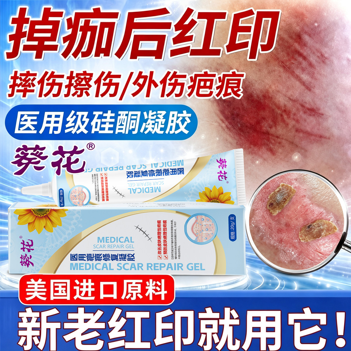 擦伤摔伤疤痕修复除疤膏掉痂后留红印黑色素沉淀医用硅酮祛疤凝胶图片