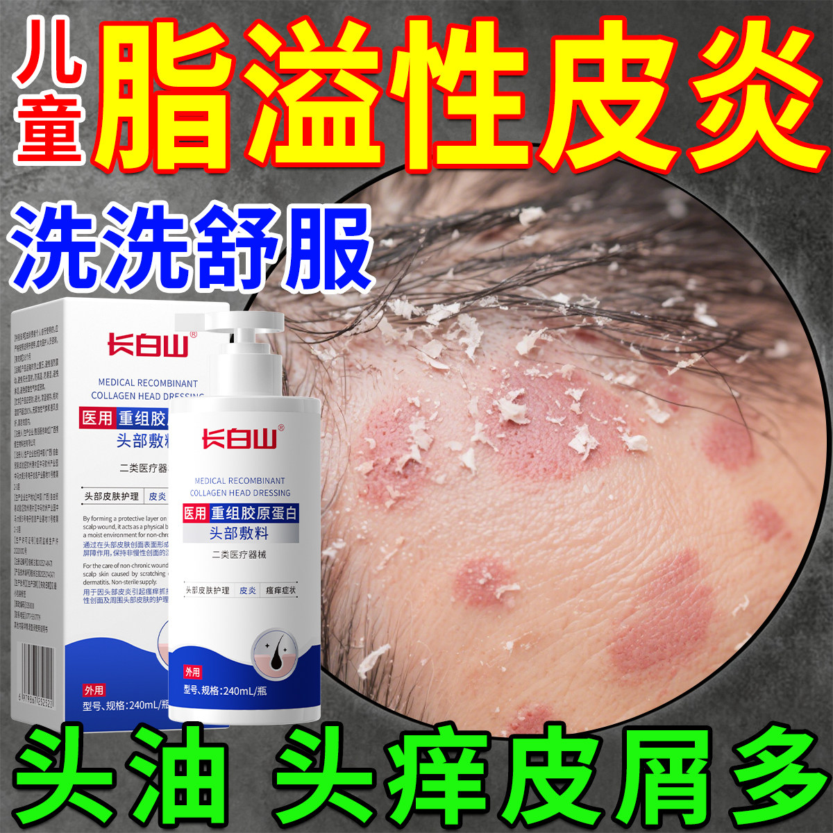 儿童头皮脂溢性皮炎洗发水皮炎毛囊炎去真菌感染头癣去屑止痒专用