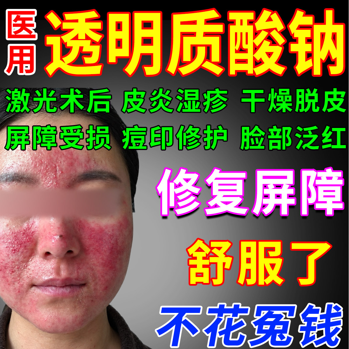 医用透明质酸钠皮肤修复凝胶脸泛红干燥起皮湿疹皮炎痤疮屏障受损