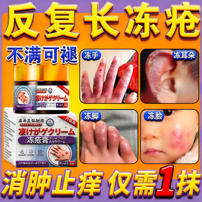 冻疮膏止痒消肿当晚看表现