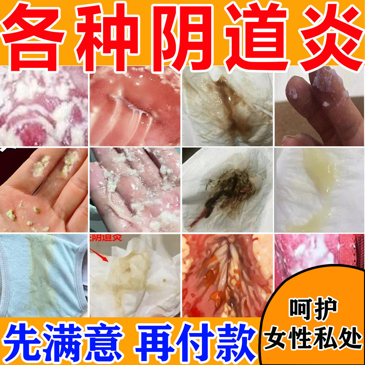 阴道炎妇科炎症专用凝胶霉菌细菌性私处痒异味阴道腥臭益生菌洗液