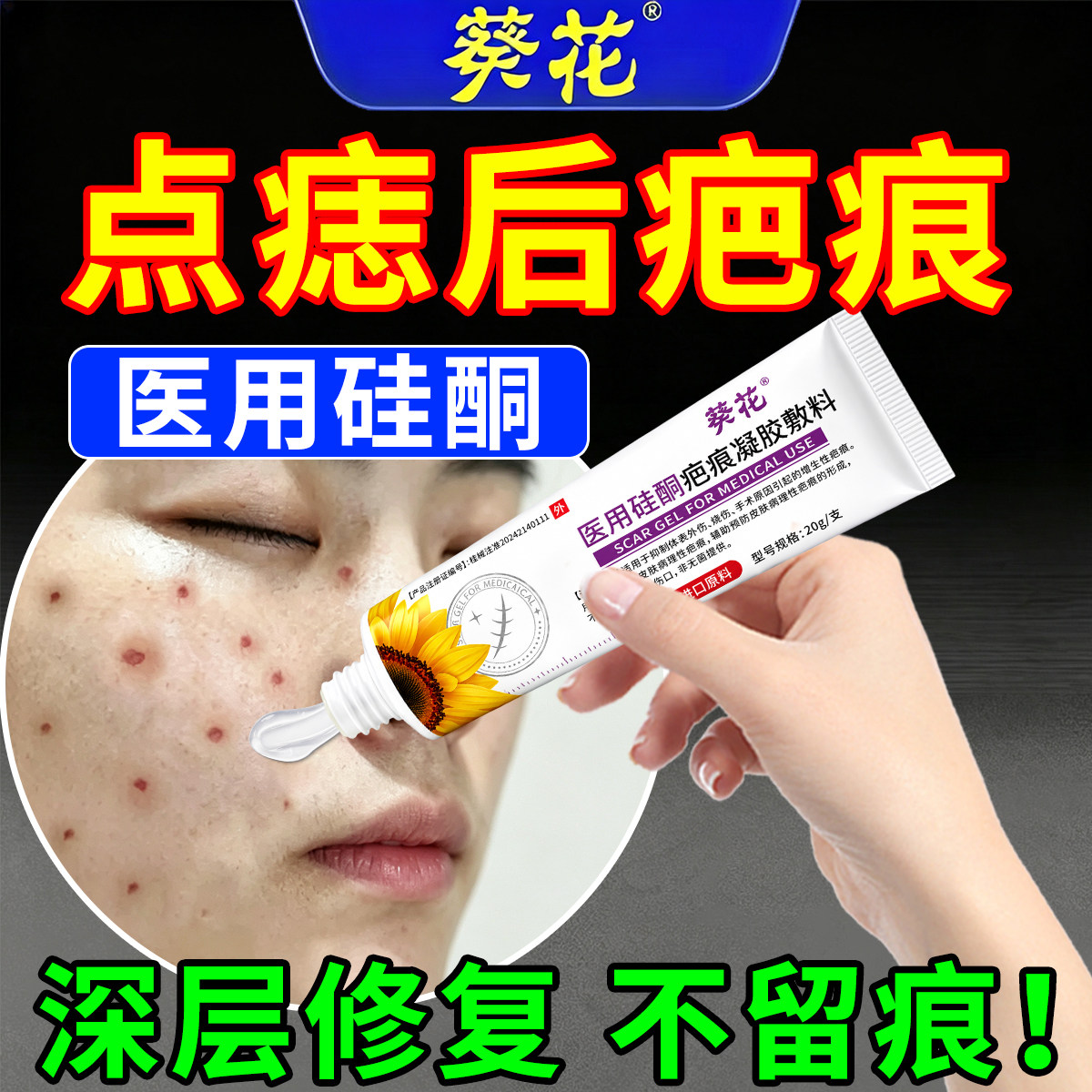 点痣后修复膏祛疤痕红印去黑印色素沉淀凸起凹陷疤痕医用硅酮凝胶图片