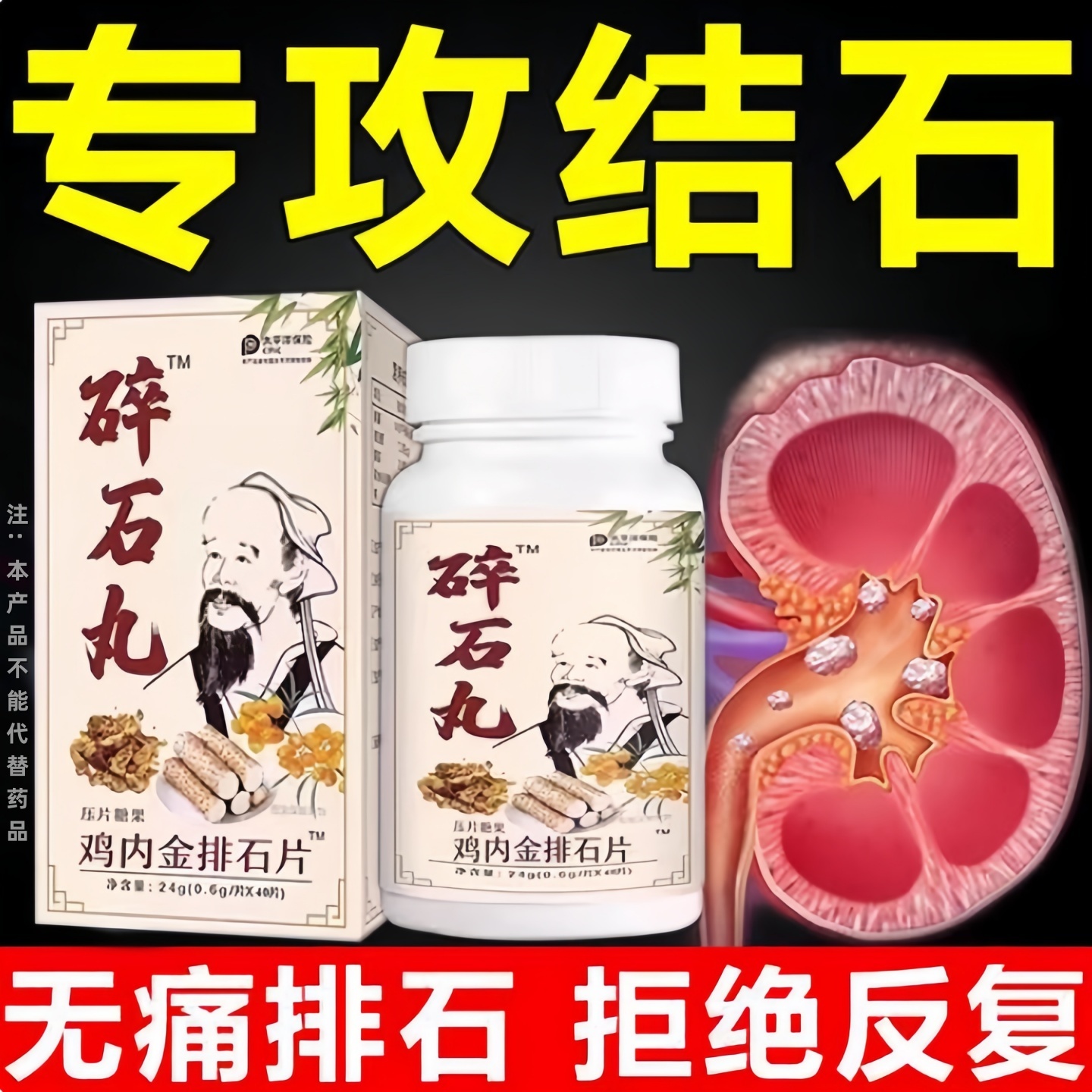 碎石丸鸡内金排石溶石化石胆石输尿管胆囊膀胱尿结石配方中草药